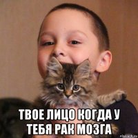  твое лицо когда у тебя рак мозга