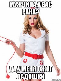 мужчина,у вас рана? да,у меня ожог ладошки
