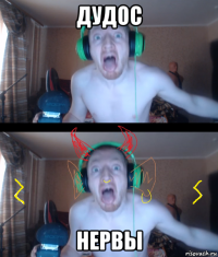 дудос нервы