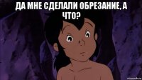 да мне сделали обрезание, а что? 