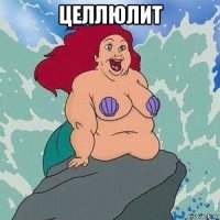 целлюлит 