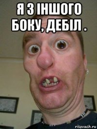 я з іншого боку, дебіл . 