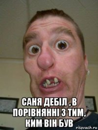  саня дебіл , в порівнянні з тим, ким він був