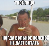 твоё лицо когда больное колено не даёт встать