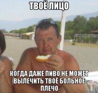 твоё лицо когда даже пиво не может вылечить твоё больное плечо