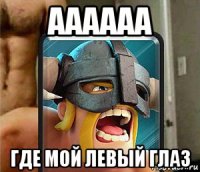 аааааа где мой левый глаз