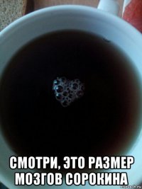  смотри, это размер мозгов сорокина