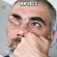 ничосе 