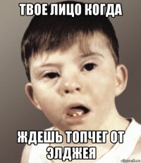 твое лицо когда ждешь топчег от элджея