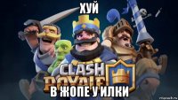 хуй в жопе у илки