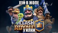 хуй в ж0пе у илки