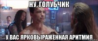 ну, голубчик у вас ярковыраженная аритмия