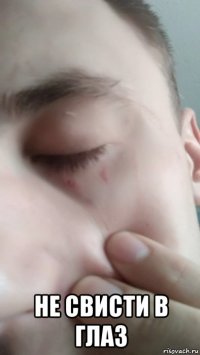  не свисти в глаз