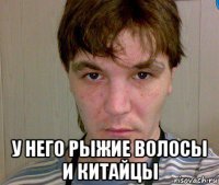  у него рыжие волосы и китайцы