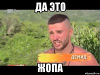 да это жопа