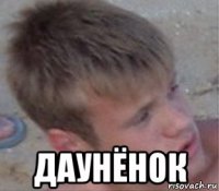  даунёнок