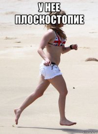 у нее плоскостопие 
