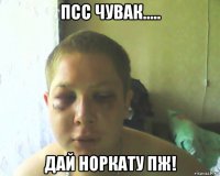 псс чувак..... дай норкату пж!