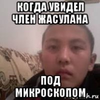когда увидел член жасулана под микроскопом