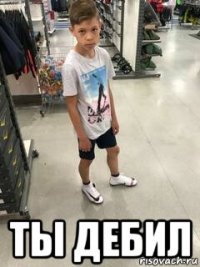  ты дебил