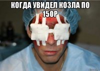 когда увидел козла по 150р 