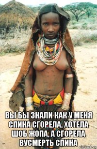  вы бы знали как у меня спина сгорела, хотела шоб жопа, а сгорела вусмерть спина