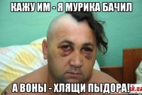 кажу им - я мурика бачил а воны - хлящи пыдора!