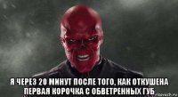  я через 20 минут после того, как откушена первая корочка с обветренных губ