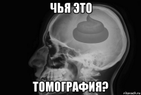чья это томография?