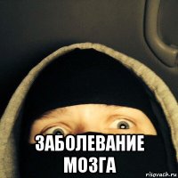  заболевание мозга