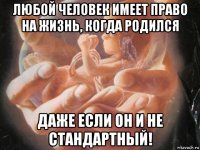 любой человек имеет право на жизнь, когда родился даже если он и не стандартный!