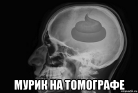  мурик на томографе