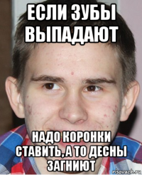 если зубы выпадают надо коронки ставить, а то десны загниют