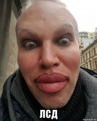  лсд