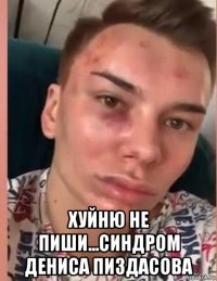 хуйню не пиши...синдром дениса пиздасова