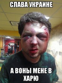 слава украине а воны мене в харю