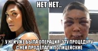 нет нет.. у ней уже была операция, эту процедуру с ней проделали полицейские