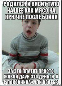 родился и висит тупо на шее как мясо на крючке после бойни за это платят просто, живой даун это деньги, а с покойника хули взять?!