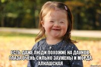  есть даже люди похожие на даунов, глаза очень сильно заужены и морда алкашская