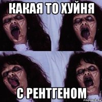 какая то хуйня с рентгеном