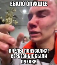 ебало опухшее пчёлы покусали?! серьезные были пчелки