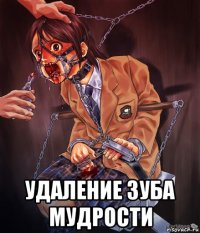  удаление зуба мудрости
