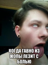  когда гавно из жопы лезит с болью