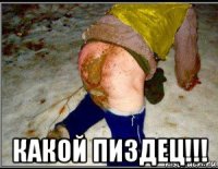  какой пиздец!!!