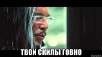 твои скилы говно