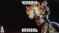 человек опухоль