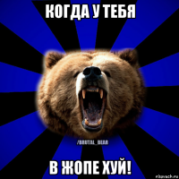 когда у тебя в жопе хуй!