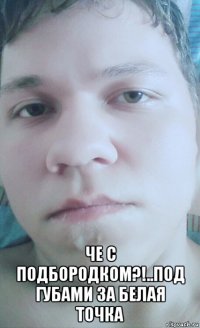  че с подбородком?!..под губами за белая точка