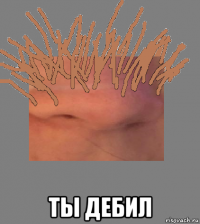  ты дебил