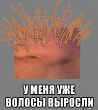  у меня уже волосы выросли